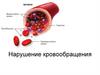 Нарушение кровообращения
