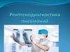 Рентгенодиагностика пневмоний