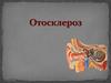 Отосклероз