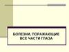 Болезни, поражающие все части глаза