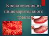 Кровотечения из пищеварительного тракта