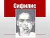 Сифилис. Происхождение