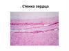 Стенка сердца