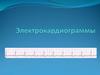 Электрокардиограммы