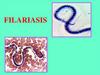 Filariasis