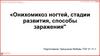 Онихомикоз ногтей, стадии развития