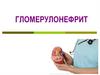 Гломерулонефрит - группа заболеваний почек