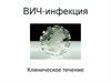 ВИЧ-инфекция. Клиническое течение