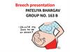 Breech presentation