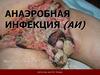 Анаэробная инфекция