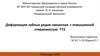 Деформации зубных рядов, связанные с повышенной стираемостью ТТЗ