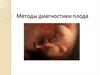 Методы диагностики плода