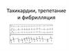 Тахикардии, трепетание и фибрилляция