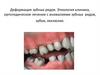 Деформация зубных рядов. Этиология клиника, ортопедическое лечение с аномалиями зубных рядов, зубов, окклюзии