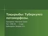 Тақырыбы: Туберкулез патоморфозы