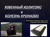 Язвенный колит(як) и болезнь крона(бк)