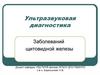 Ультразвуковая диагностика. Заболеваний щитовидной железы