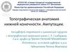 Топографическая анатомия нижней конечности. Ампутации