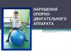Нарушения опорно-двигательного аппарата