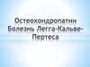 Остехондропатии у детей. Болезнь Пертеса