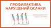 Профилактика нарушений осанки