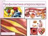 Профилактика атеросклероза