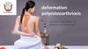 Deformation Polyosteoarthriosis