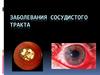 Заболевания сосудистого тракта