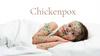 Сhickenpox. What is that