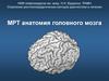 Анатомия головного мозга МРТ