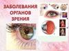 Заболевание органов зрения