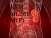 Acute renal failure (ARF)