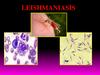 Leishmaniasis