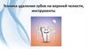 Техника удаления зубов на верхней челюсти, инструменты
