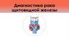 Диагностика рака щитовидной железы