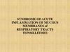 Syndrome of acute inflammation of mucous membranes of respiratory tracts. Tonsillitises