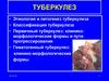 Туберкулез. Этиология и патогенез туберкулеза