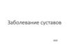 Заболевания суставов