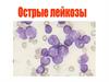 Острые лейкозы