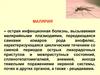 Малярия основные аспекты