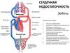 Сердечная недостаточность