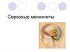 Серозные менингиты