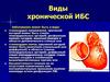 Виды хронической ИБС