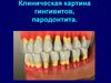 Клиническая картина гингивитов, пародонтита