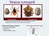 Укус клеща