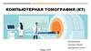 Компьютерная томография (КТ)