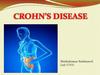 Crohn's Disease
