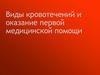 Виды кровотечений и оказание первой медицинской помощи