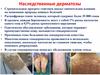 Наследственные дерматозы