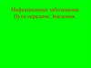 Инфекционные заболевания. Пути передачи. Эпидемия